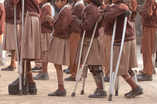 Children crippled by polio
